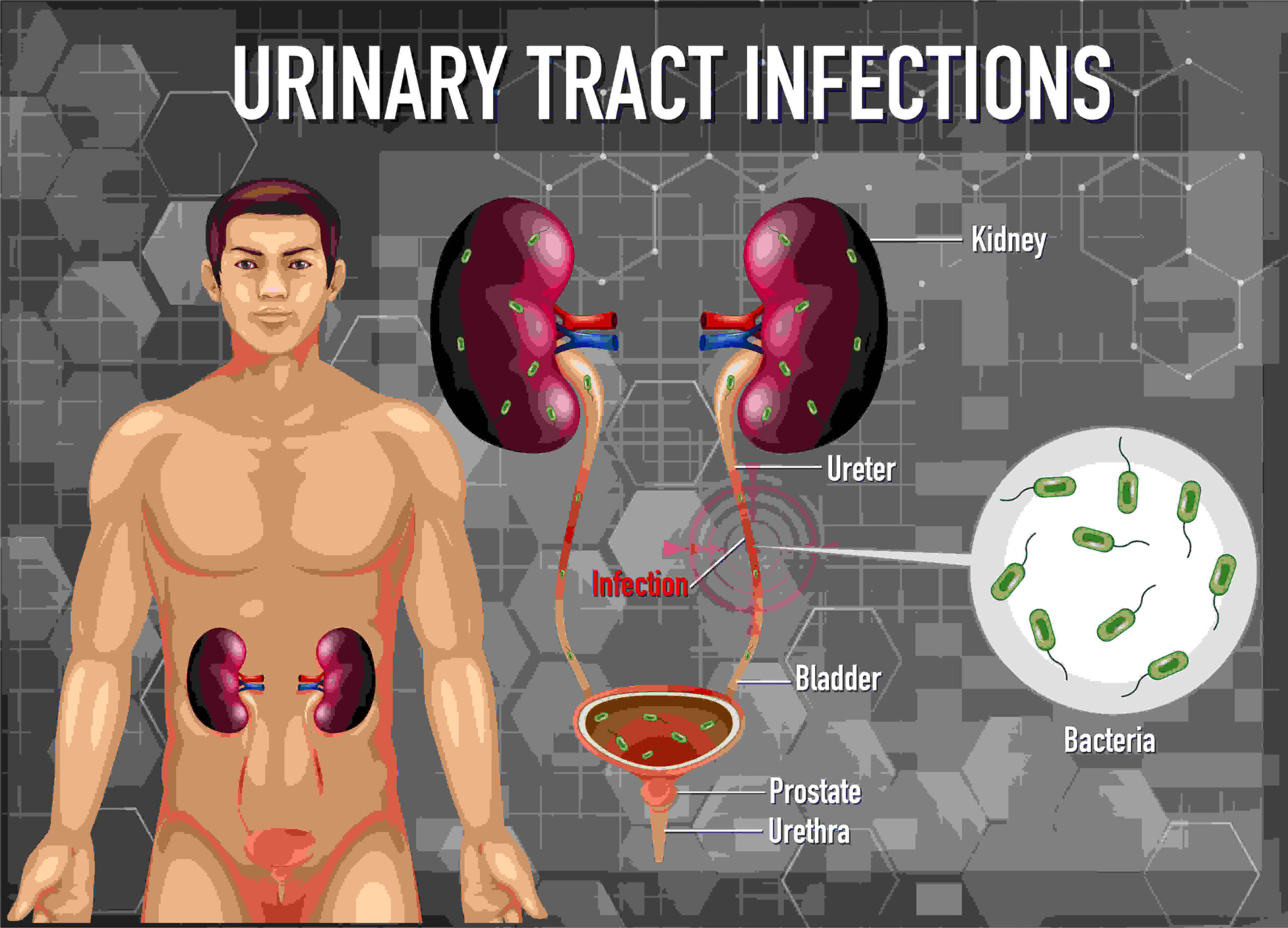 Kidney disease causes, symptoms and treatment