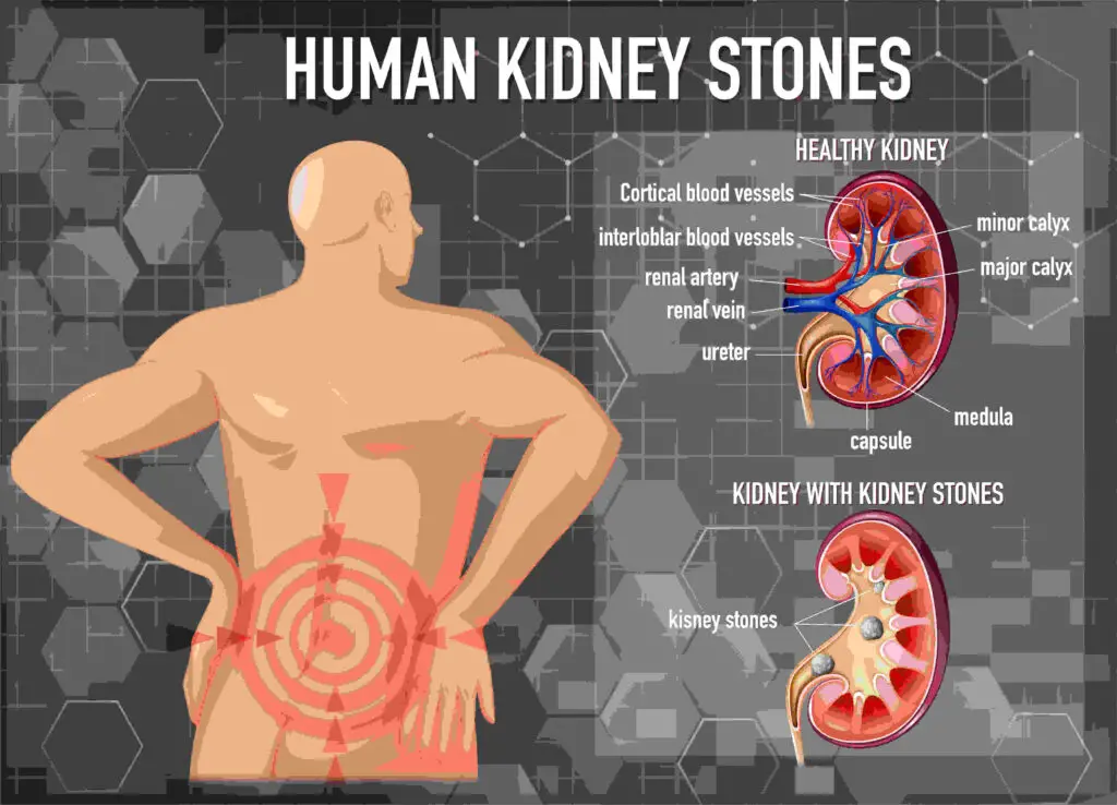 Kidney disease causes, symptoms and treatment