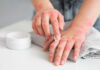 Scabies home treatment