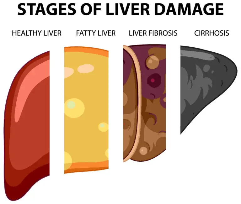 Signs of death in liver cancer patients