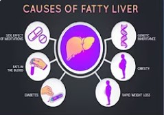 Fatty liver