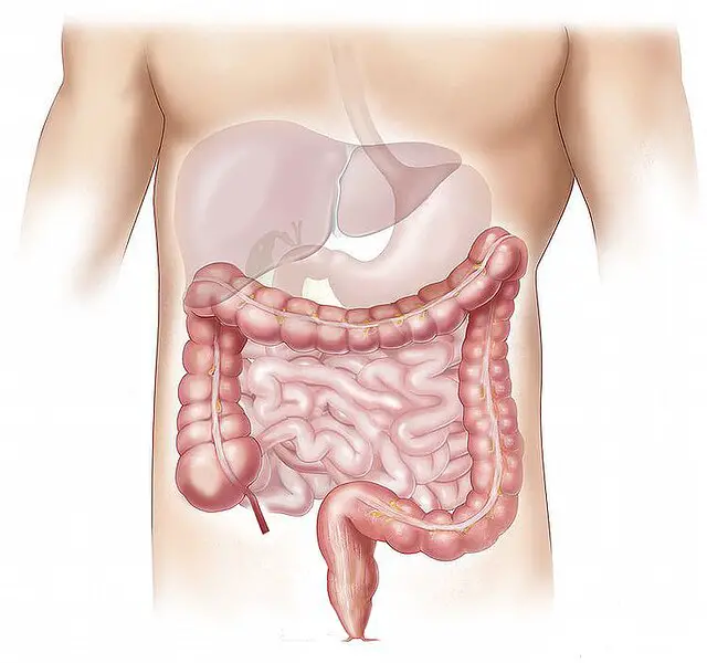 Treatment of fatty liver grade 2