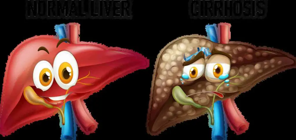 Symptoms of liver damage