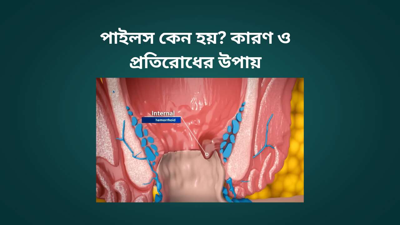 পাইলস-কেন-হয়