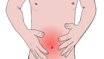 What-to-do-in-case-of-diarrhea