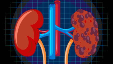 কিডনি-রোগ-কি-ভাল-হয়