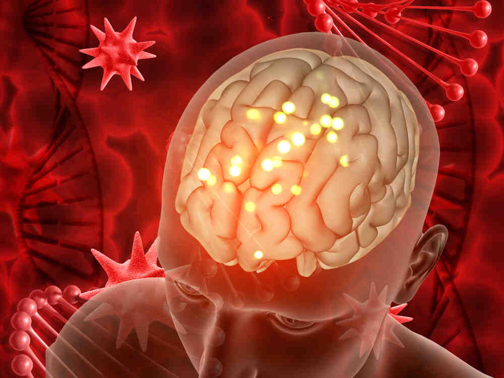Brain-tumor-symptoms